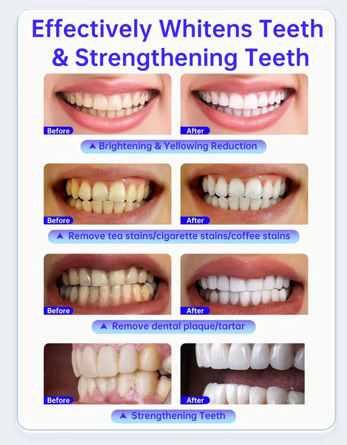 Benzi de Albire Dentară